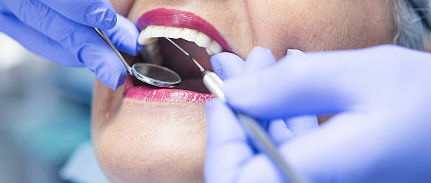 Best Emergency Root Canal Treatment in Jonesboro, IL